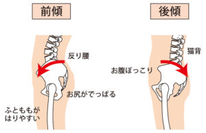 太ももを細くする 方法 40代 ダイエット 骨盤