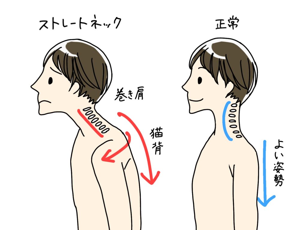 首を細くする マッサージ セルフケア方法 ストレートネック