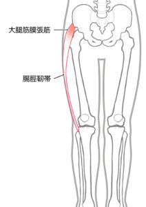 太ももを細くする 方法 40代 ダイエット 大腿筋膜張筋