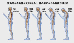 ストレートネック　スマホ