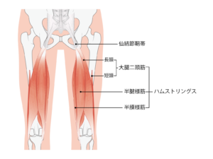 骨盤後傾 反り腰 原因 対処法 ハムストリング