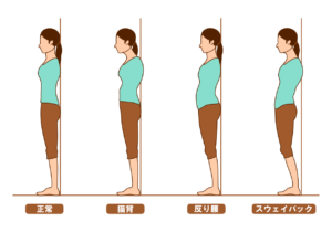 整体 猫背 治らない 理由 対処法