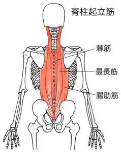 骨盤後傾 反り腰 原因 対処法　脊柱起立筋