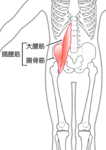 骨盤後傾 反り腰 原因 対処法　腸腰筋