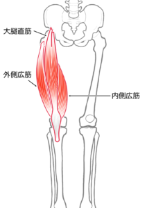 Ｏ脚 足首から曲がっている 原因 対処法 内側広筋