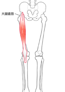 骨盤後傾 反り腰 原因 対処法　大腿直筋