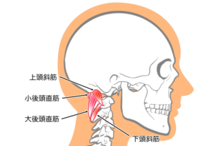 整体 猫背 治らない 理由 対処法 後頭下筋群