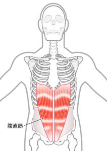 整体 猫背 治らない 理由 対処法 腹直筋