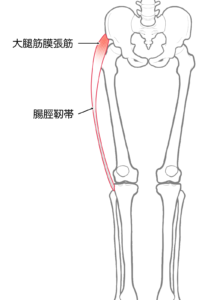 Ｏ脚 足首から曲がっている 原因 対処法 大腿筋膜張筋