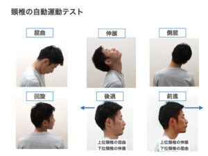 ストレートネック 治し方