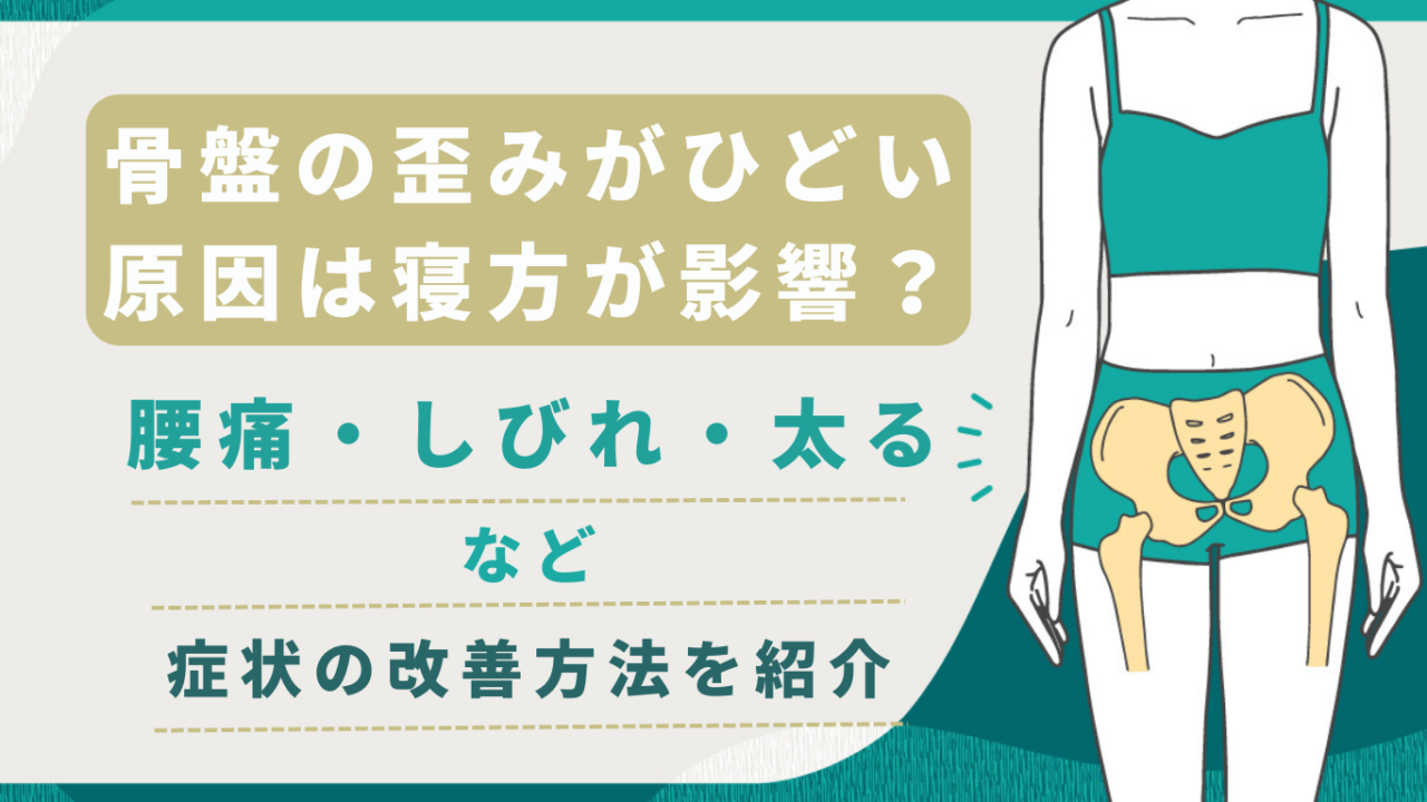 骨盤の歪みがひどい原因は寝方が影響？腰痛・しびれ・太るなど症状の改善方法を紹介